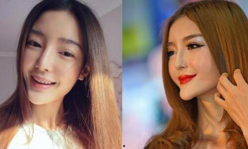 娱乐圈整容失败女星,美丽代价与反思