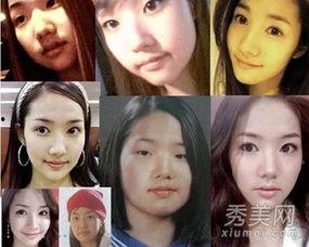 娱乐圈整容失败女星,美丽代价与反思  第3张